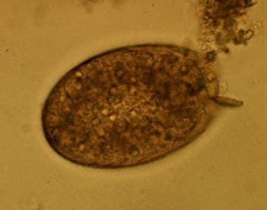 Egg of Fasciolopsis buski. Images reproduced from 