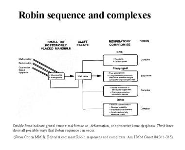 Pierre Robin sequence and complexes. 