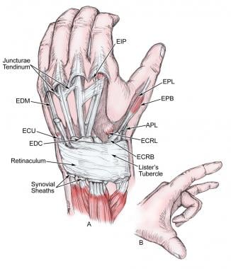 Extensor system of the hand. Note the juncturae te