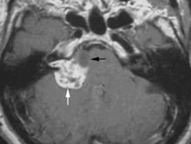 Contrast-enhanced T1-weighted axial magnetic reson