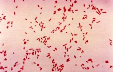 Escherichia coli on Gram stain. Gram-negative baci