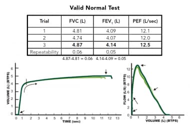 Example of an acceptable spirometry testing sessio