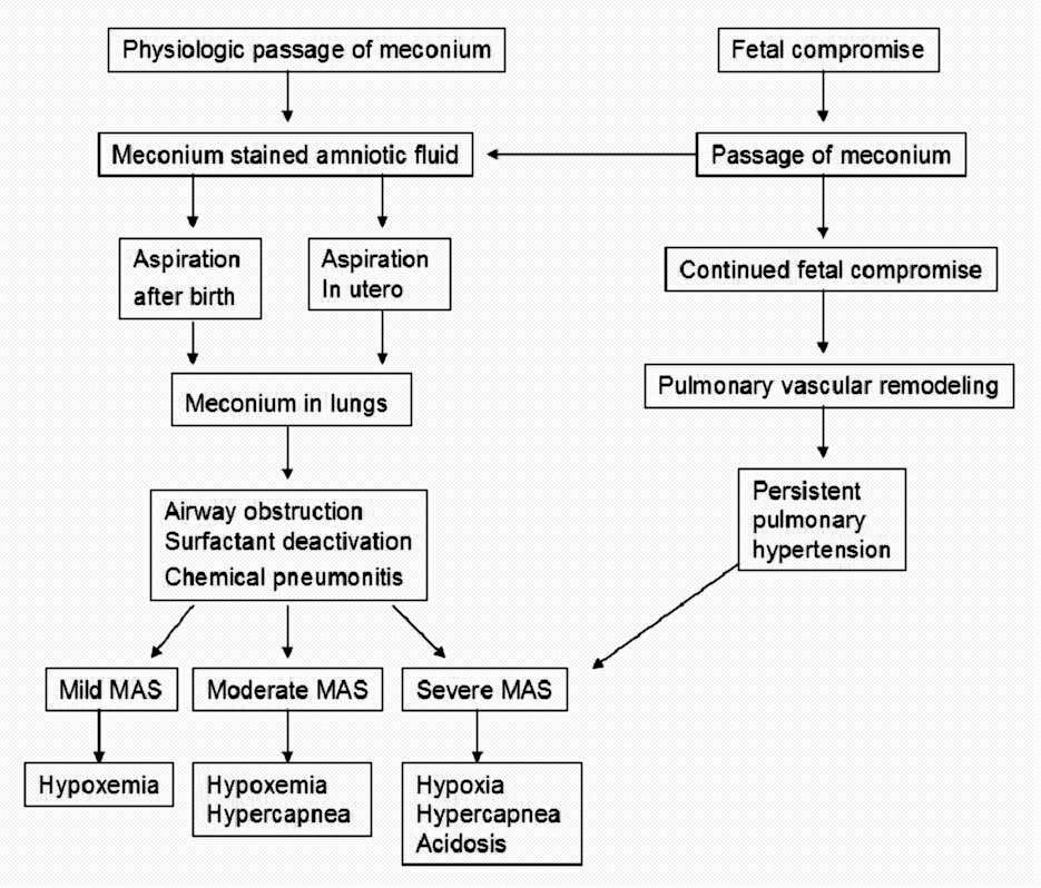 meconium in amniotic fluid