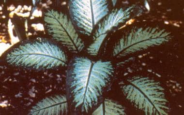 Dieffenbachia, commonly known as dumb cane
