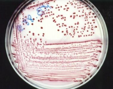 Escherichia coli culture on MacConkey agar.