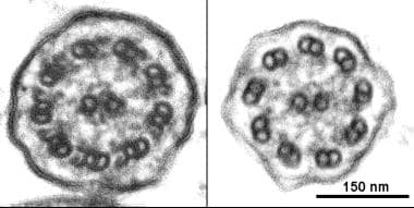 Ciliary ultrastructure, Left, Normal cilium from a