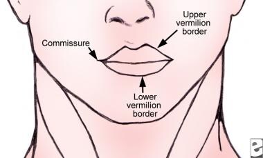 Illustration of the upper and lower vermilion bord