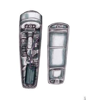 Internal components of an electrolarynx. 