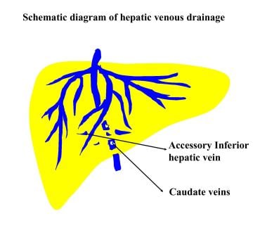 Diagram of hepatic venous drainage depicts the sma