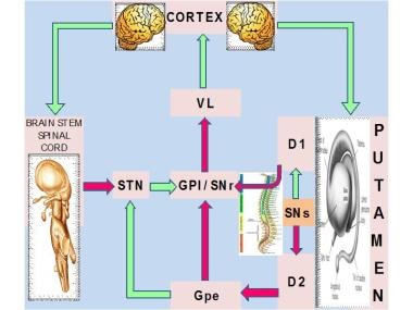 Idiopathic torsion dystonia. Major nuclear complex