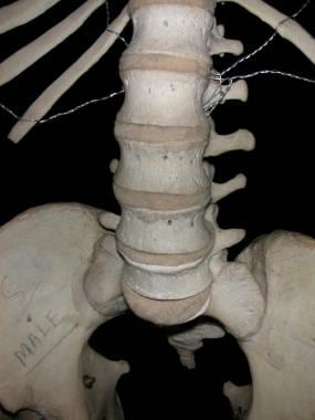 Anterior view of lumbar spine, showing lumbar vert