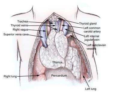 Thymus gland and surrounding structures.