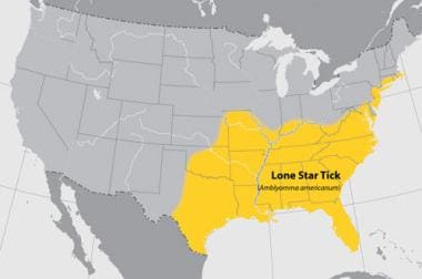 Map of the United States showing the distribution 