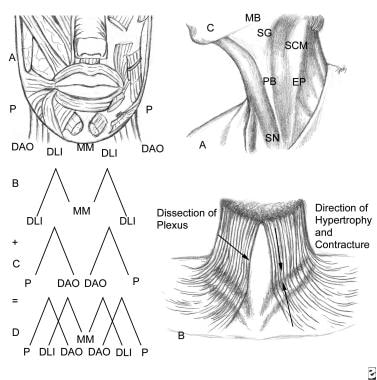 The anatomy of the muscles of the lower lip can be