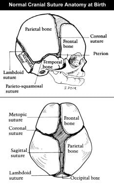Congenital, synostoses. Normal cranial suture anat