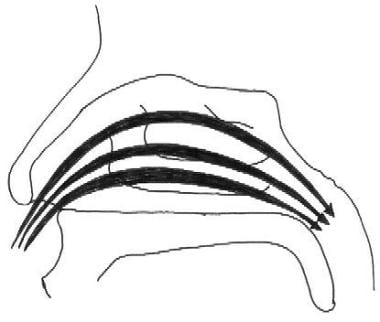 The normal flow of air through the nose should be