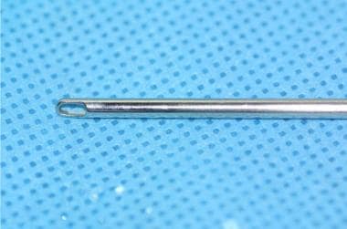 A 6-mm straight suction cannula commonly used in c