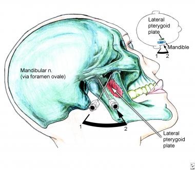 Anatomy of mandibular block and needle insertion t