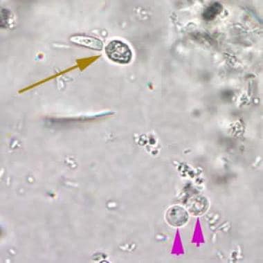 Cryptosporidium species oocysts are rounded and me