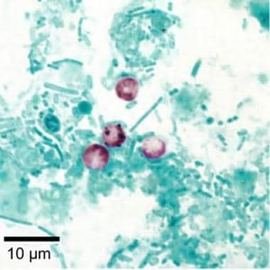 Cryptosporidium parvum oocysts revealed with modif