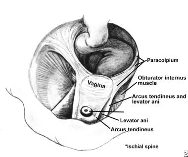 The vagina and supportive structures. Paracolpium 
