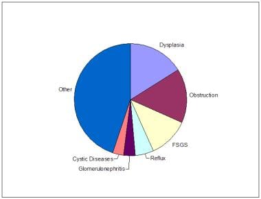 Etiology of end-stage renal disease in North Ameri