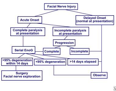 Image result for bell's palsy