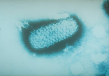 Smallpox virion. Courtesy of US Centers for Diseas