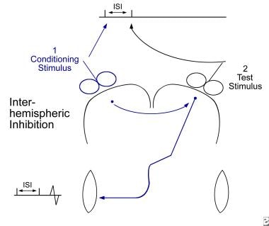 Interhemispheric conditioning study. A conditionin