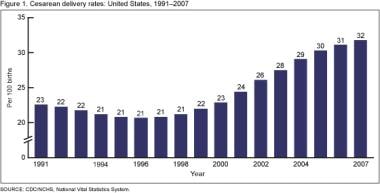 Cesarean delivery rates, United States. 