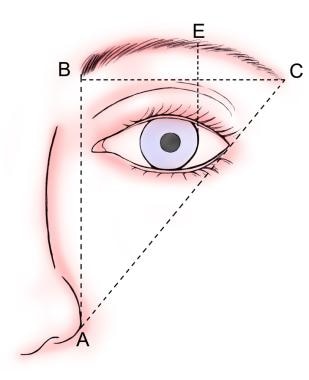Direct brow lift. Ideal brow position. 