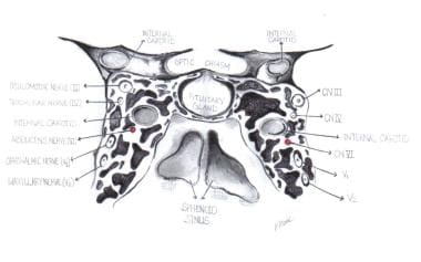 Cavernous sinus and its cranial nerves. 