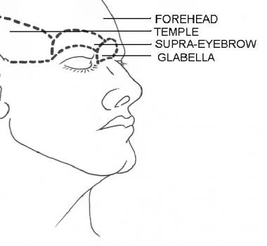Forehead subunits. Illustrated by Charles Norman. 