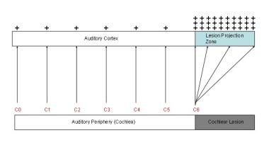 Tinnitus model. Two phenomena in the auditory cort