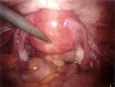 Female Urinary Organ Anatomy: Overview, Gross Anatomy, Microscopic Anatomy