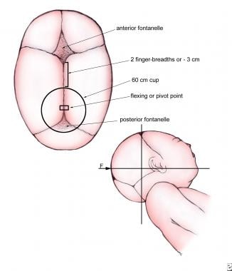 Cranial flexion or pivot point. 
