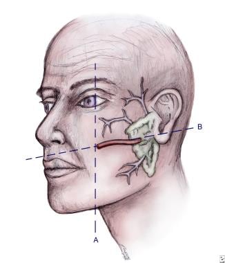 Location of parotid gland and duct system. 
