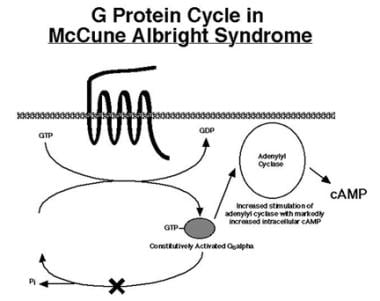 Mutations in McCune-Albright syndrome inactivate i