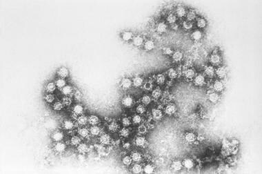 Coxsackievirus B4 virions under electron microscop
