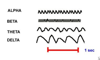 Examples of alpha, beta, theta, and delta electroe