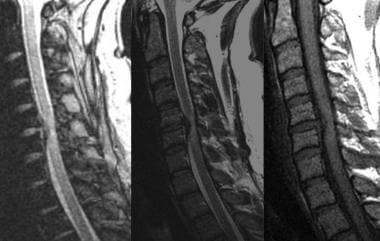 Sagittal T1- and T2-weighted gradient-echo images 