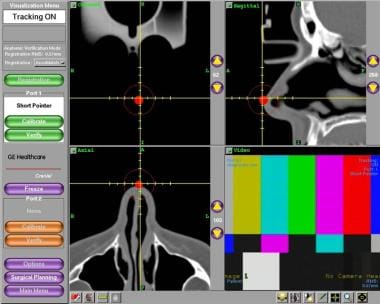 Verification of accuracy using patient anatomic la