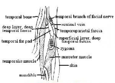 Cross section illustrating anatomy of temporal reg