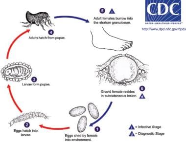 Life cycle of the chigoe flea, Tunga penetrans. 