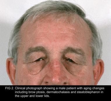 Clinical photograph showing a male patient with ag