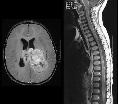 T1-weighted postcontrast images of the axial head