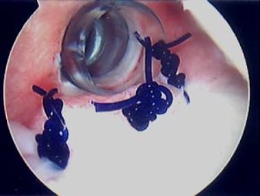 Completed third knot. Photo courtesy of Daniel C W