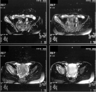 Magnetic resonance images from an 11-year-old boy 
