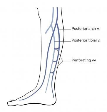 Lower-leg venous anatomy. 