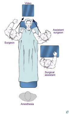 Illustration of the room setup for endoscopic repa
